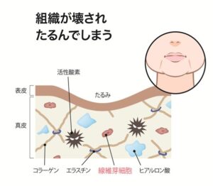 組織が壊れる