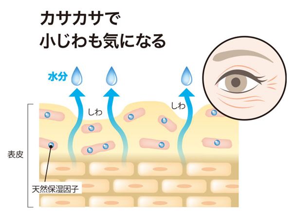 小じわ