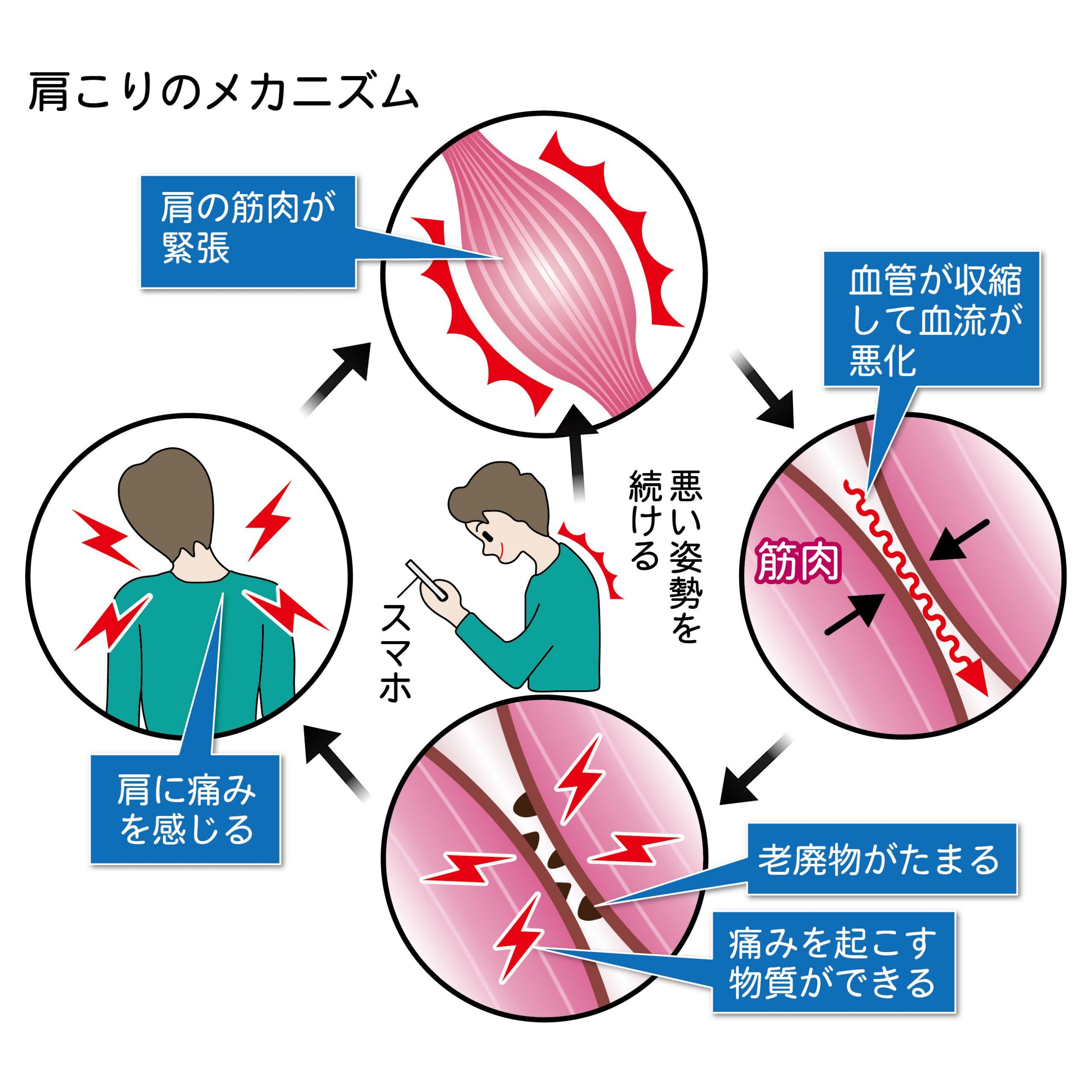 肩凝り