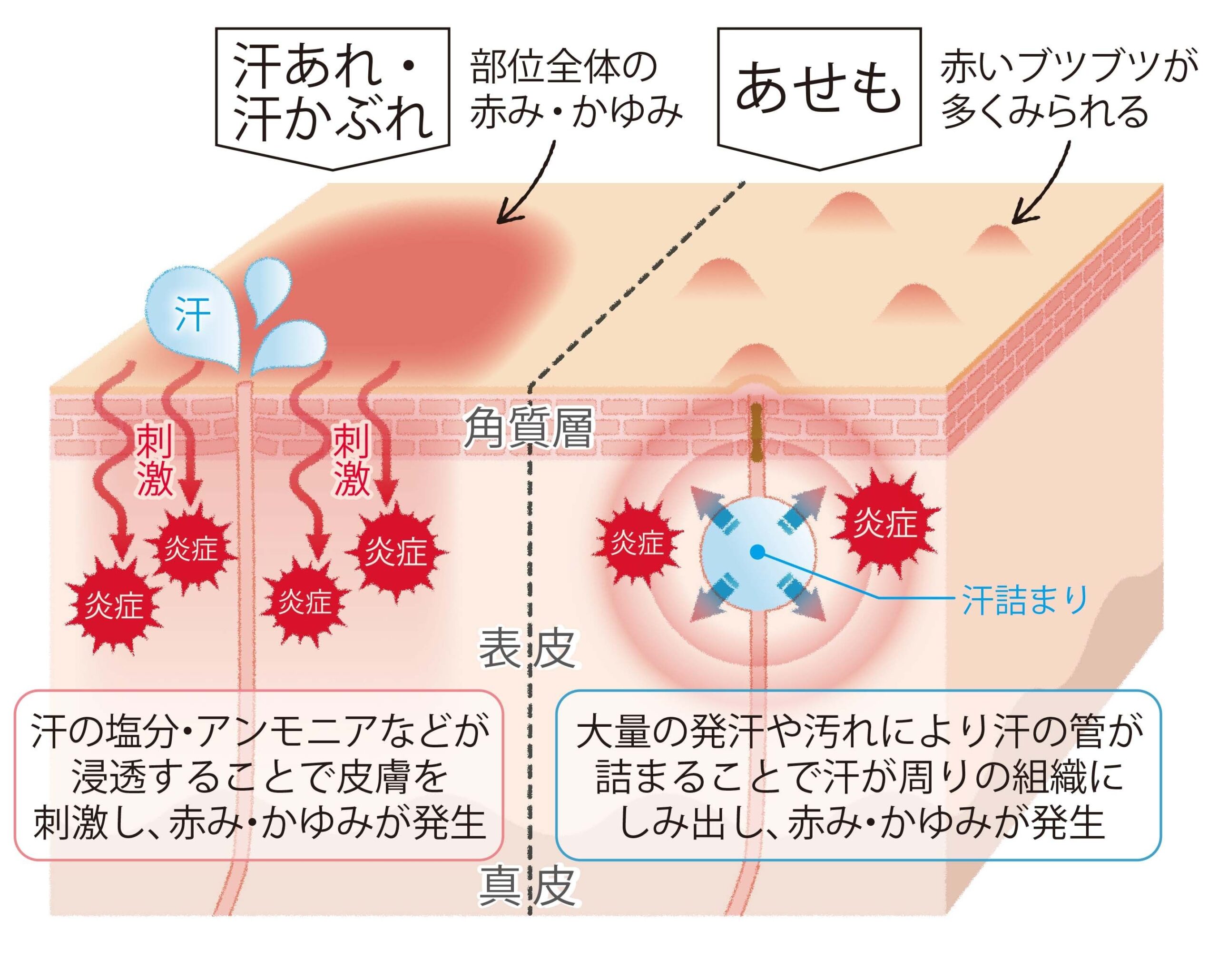 首 汗 かく