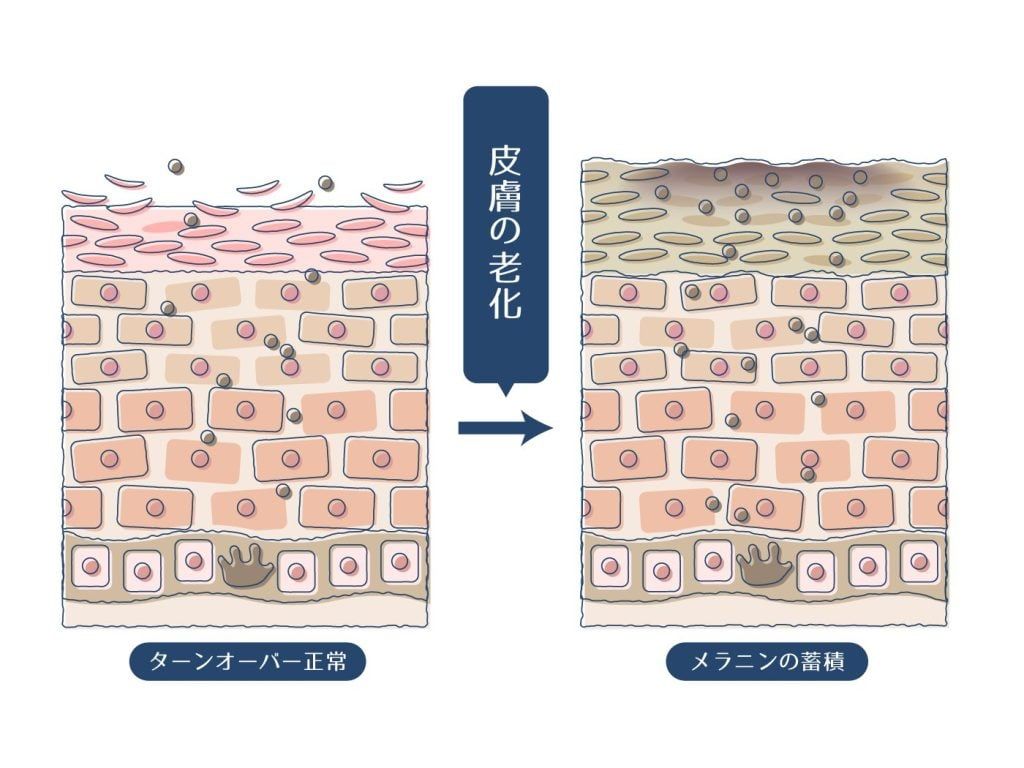 茶色い斑点