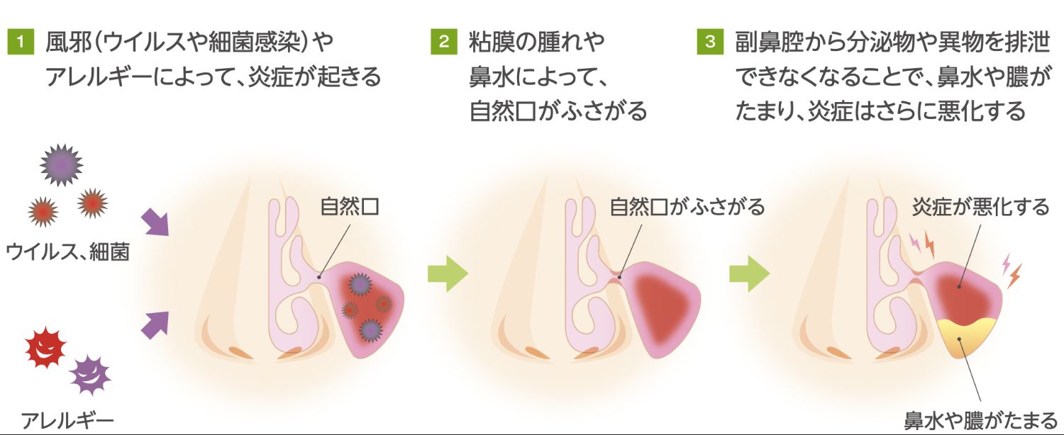 はな