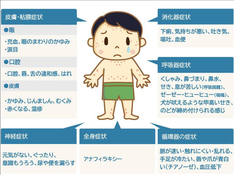 乳幼児のアレルギ