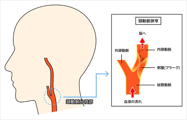 首