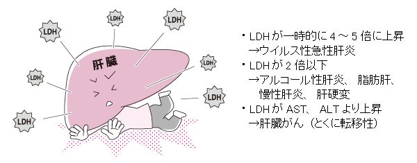 LDH