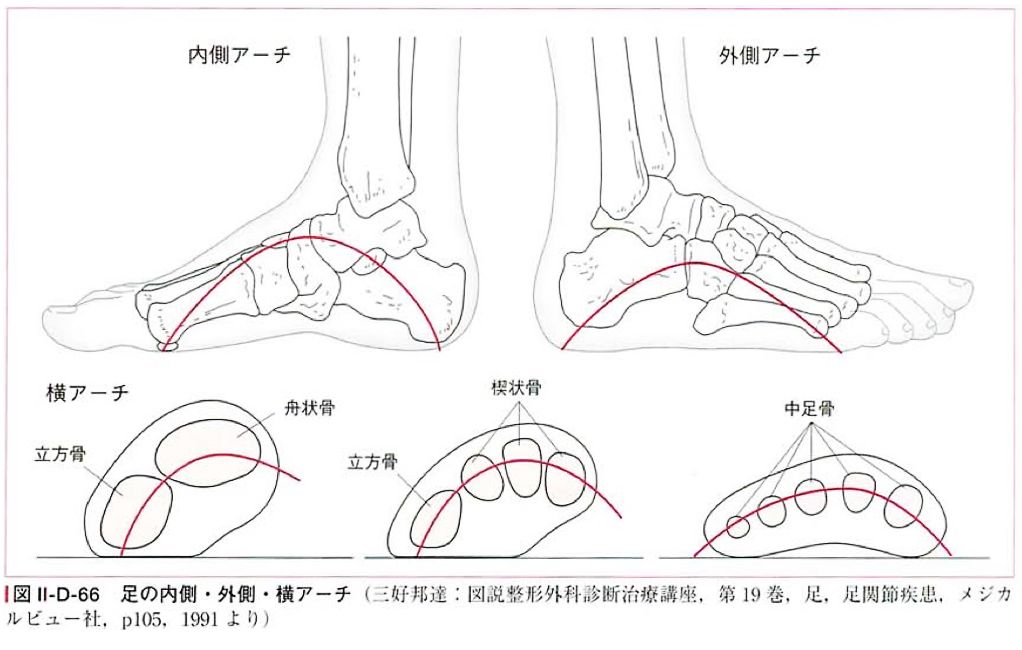 アーチ