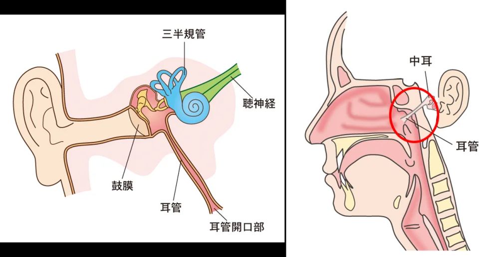 中耳炎