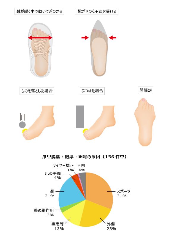 爪内出血