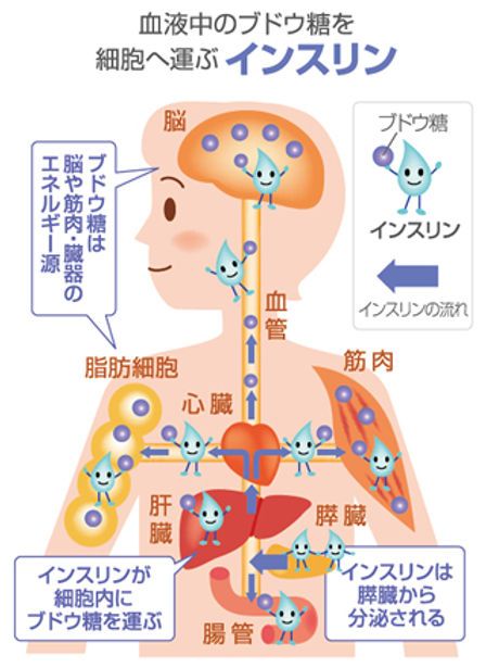 糖尿病