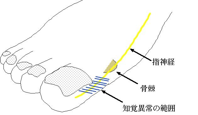 親指