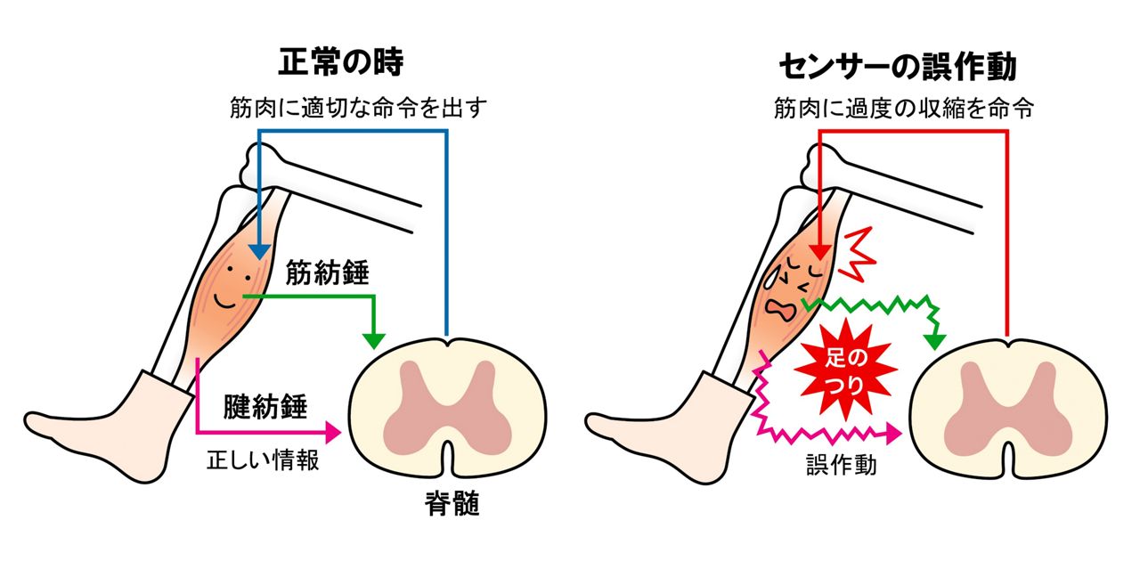 足つる