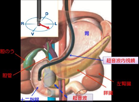 内視鏡